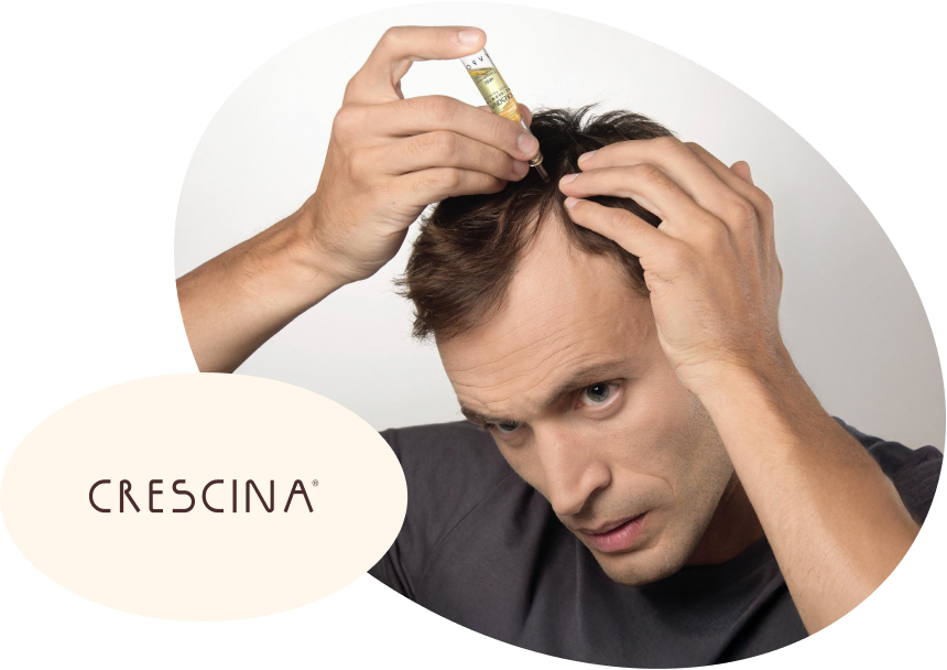 Crescina Nepal - Shop Hair Loss Treatments