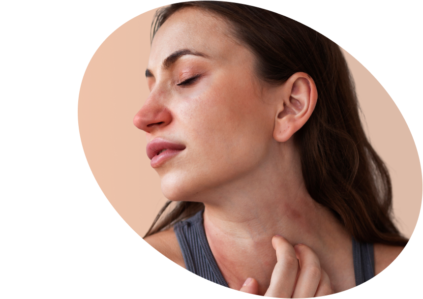 Allergy Season - Allergy Relief Essentials Ireland