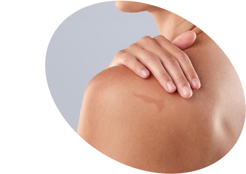 Dark  Spots  &amp; Body  Hyperpigmentation  - Shop  Brightening  Products  الكويت