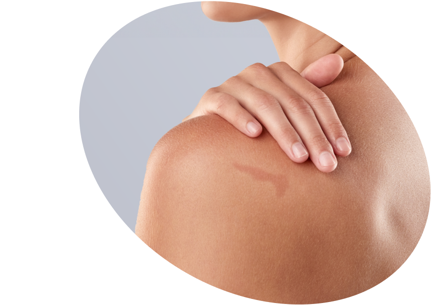 Dark Spots &amp; Body Hyperpigmentation - Shop Brightening Products South Africa