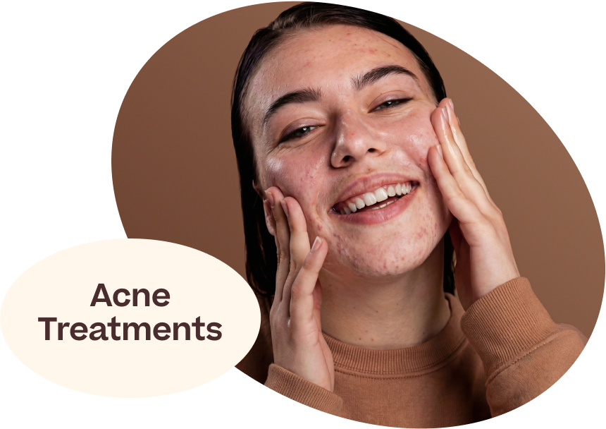 Acne Skincare - Shop Serums &amp; Creams for Acne &amp; Pimples Mexico