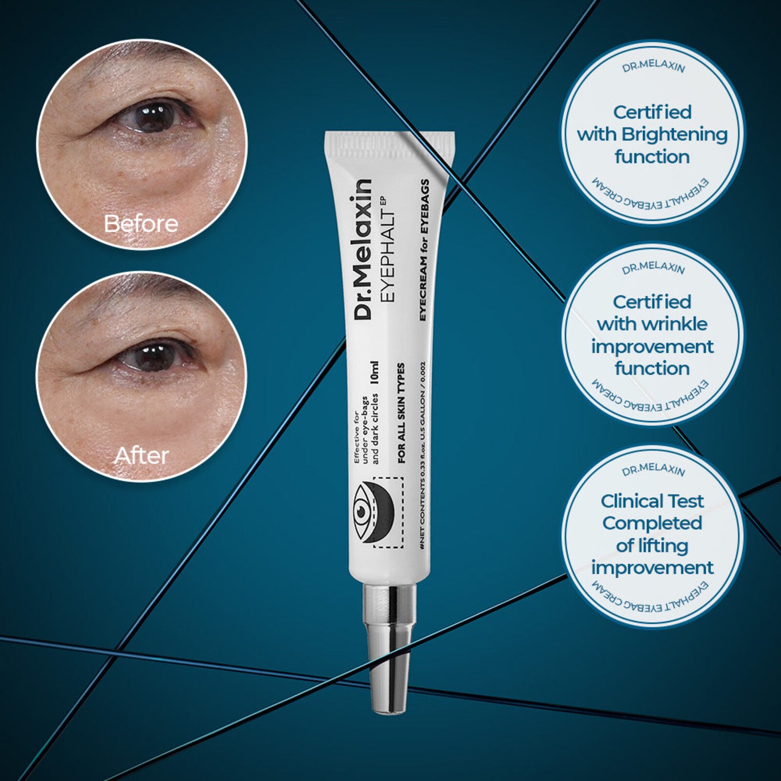 Dr.melaxin Eyephalt Eyebag Cream 10g Brasil