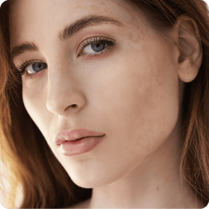 Dark Spots Sunscreen