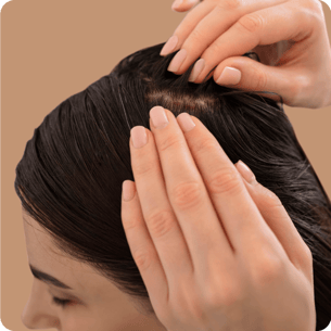 صدفية فروة الرأس