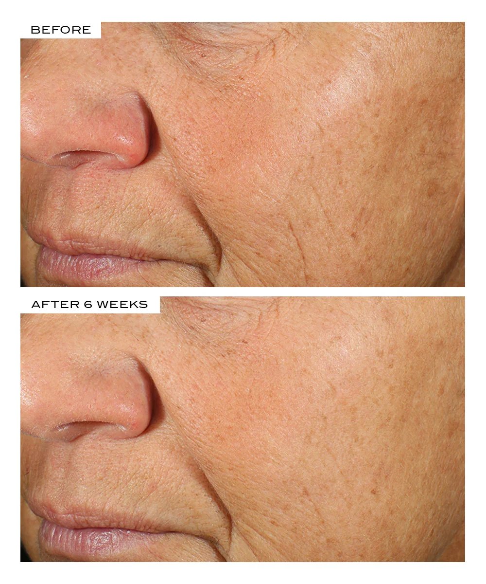 111SKIN Black Diamond Cream 50ml