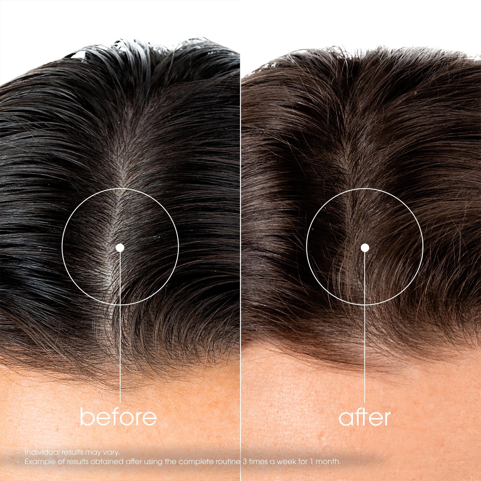 Klorane Strengthening Shampoo for Hair Loss & Thinning 400ml (13.53floz)
