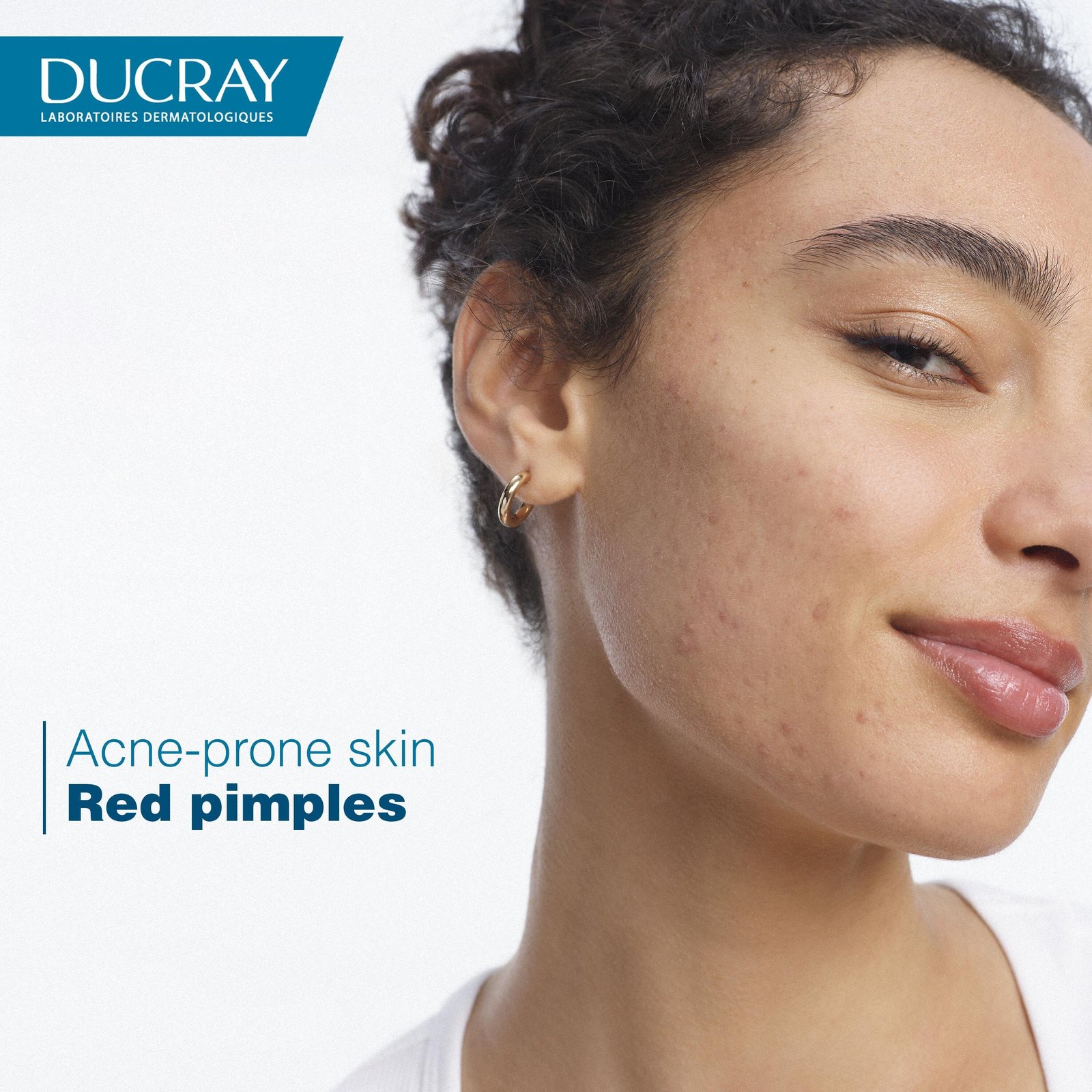 Ducray Keracnyl PP+ Anti-Blemish Cream 30ml
