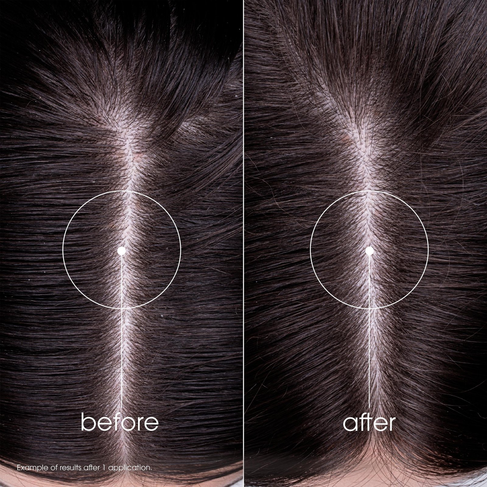 Klorane Oil Control Shampoo with Nettle 400ml