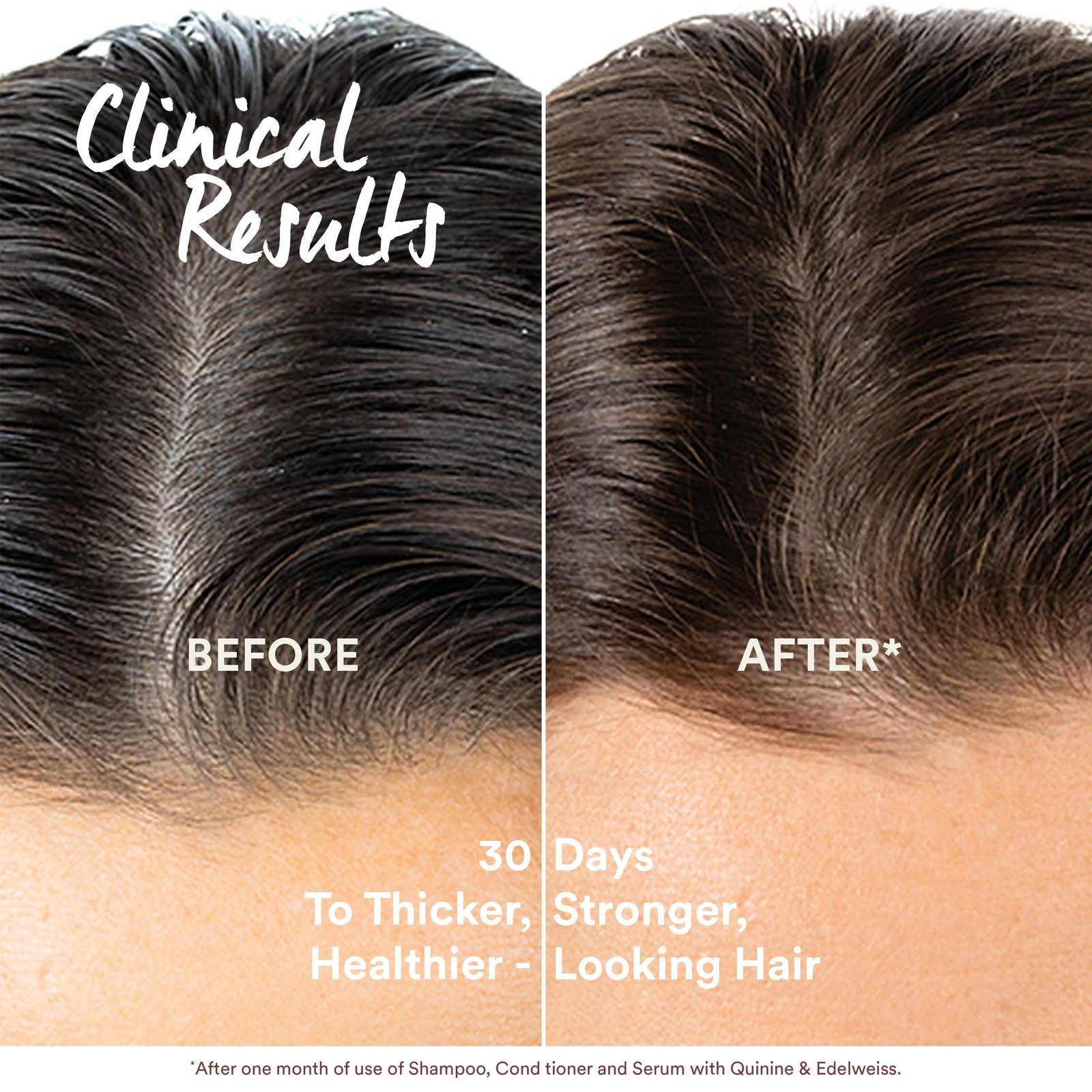 Klorane Anti-Hair Loss Serum 100ml