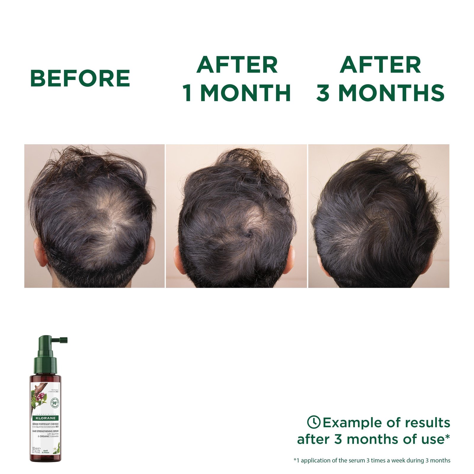 Klorane Anti-Hair Loss Serum 100ml