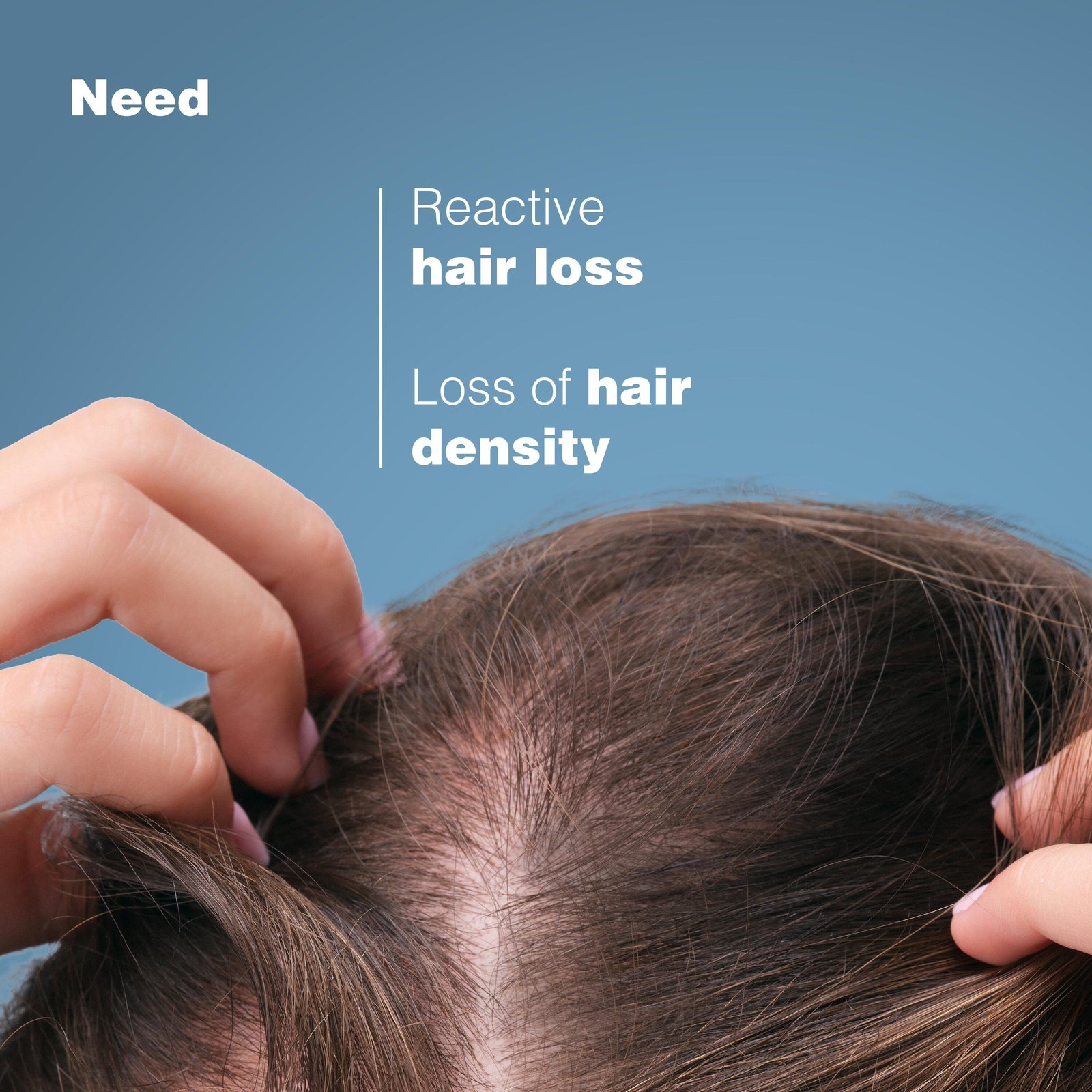 Ducray Anaphase Creastim Anti-Hair Loss & Growth Lotion 60ml