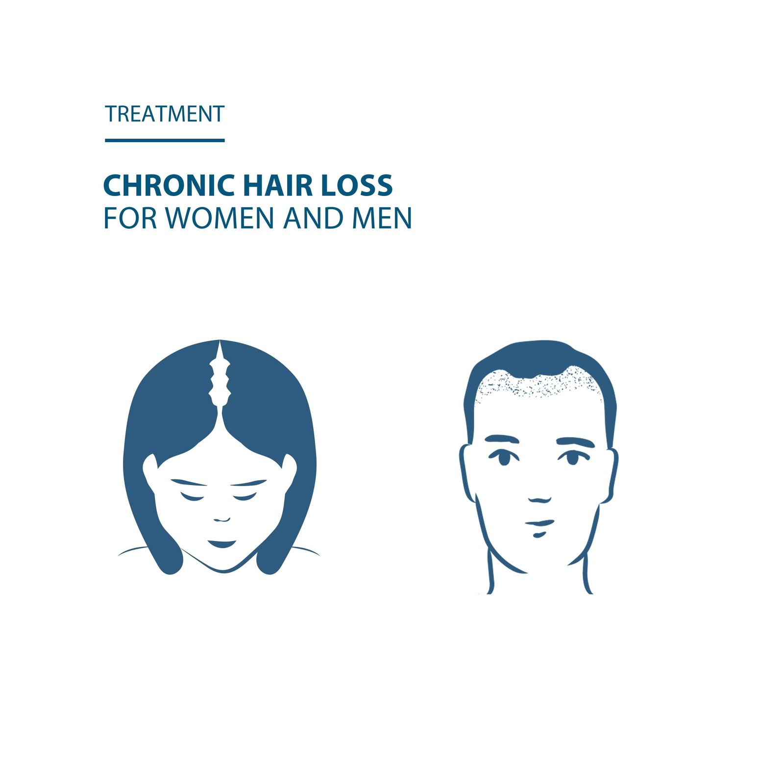 Ducray Anacaps Expert for Chronic Hair Loss 3x30