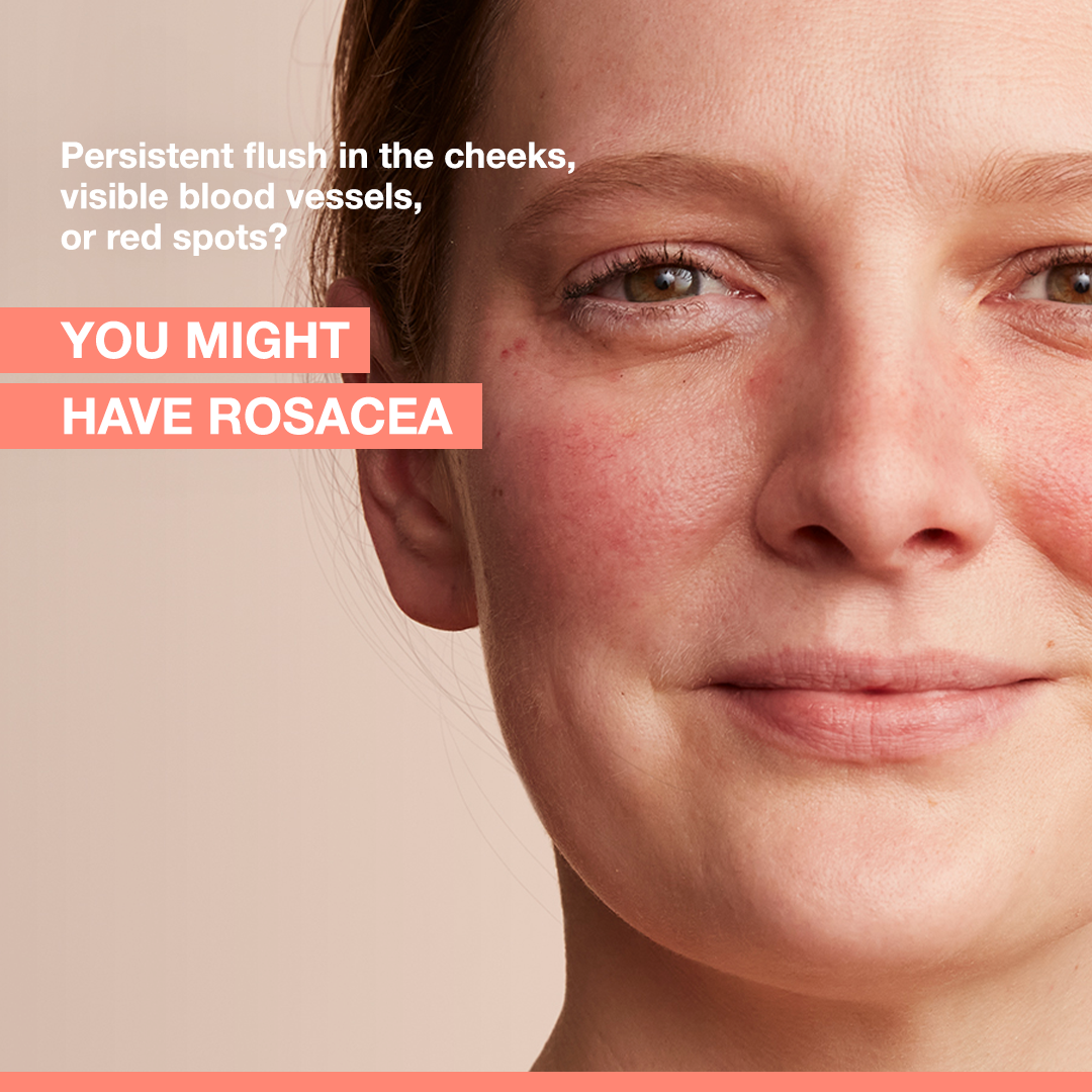 Avène Antirougeurs Rosamed Chronic Redness Concentrate Cream 30ml (1.01floz)