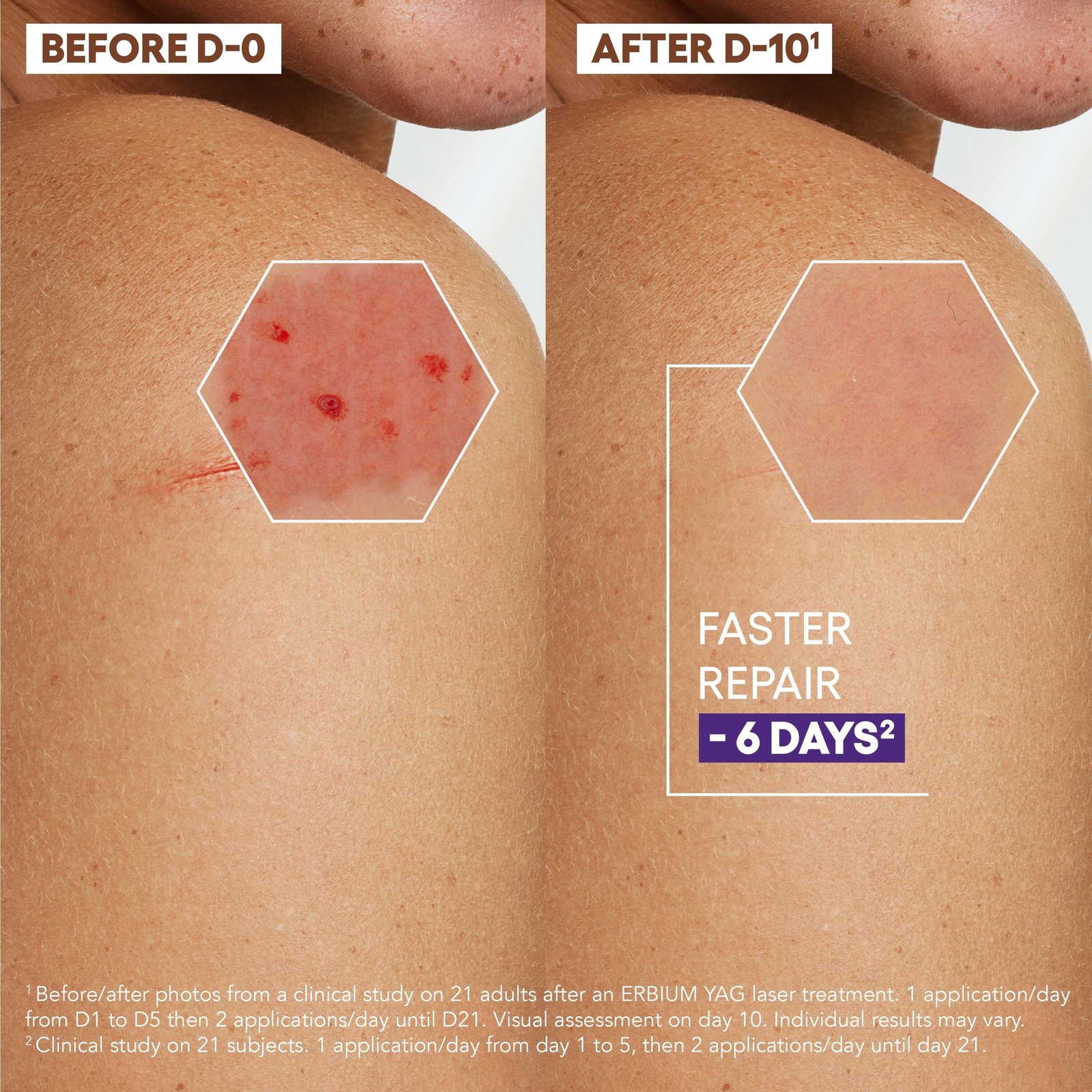 A-Derma Epitheliale Ultra Repair HA+ Anti-Marks Repairing Cream 100ml
