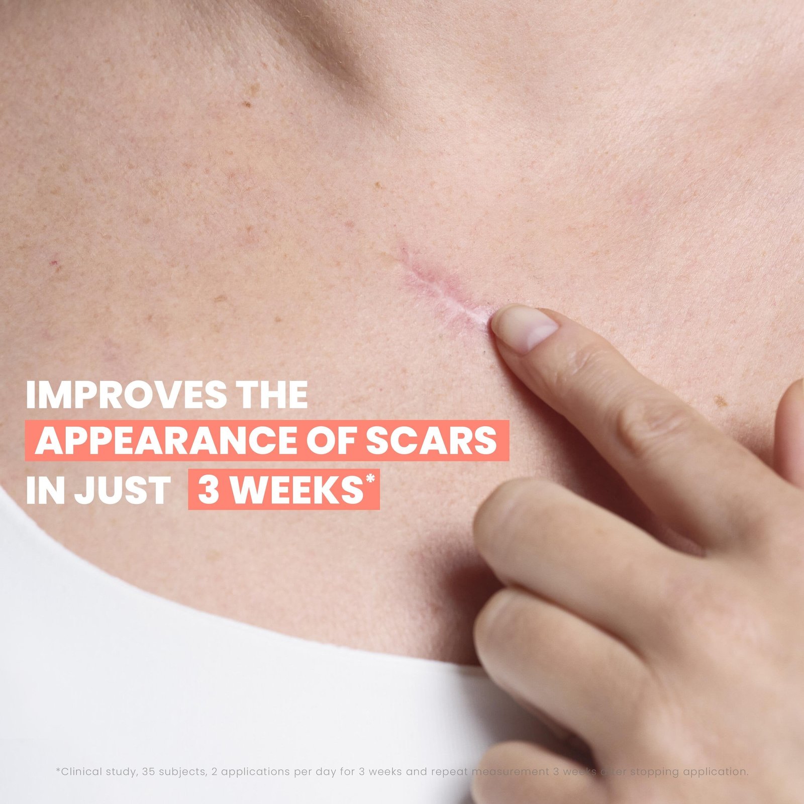 Avène Cicalfate+ Remodeling Scar Gel 40ml