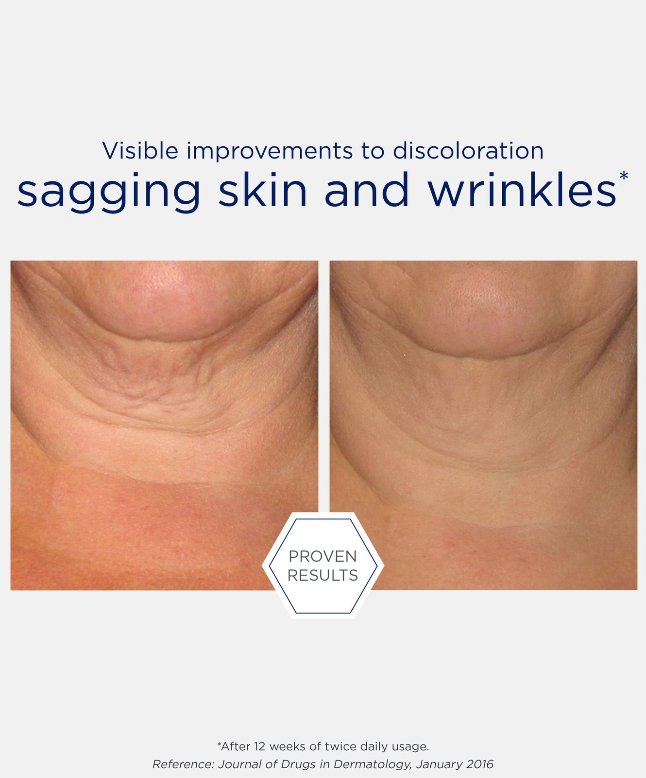 NeoStrata Skin Active Triple Firming Neck Cream 80g (2.82oz)