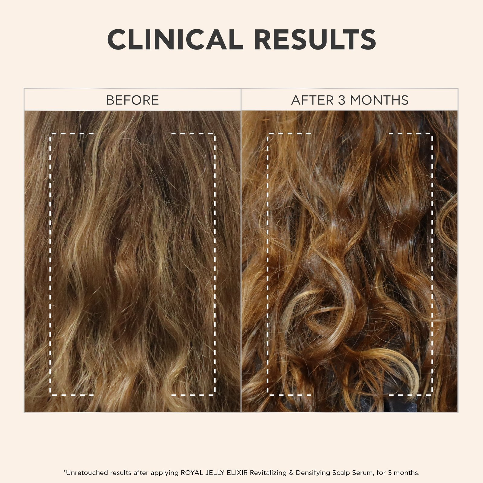 APIVITA Royal Jelly Elixir Revitalizing & Densifying Scalp Serum 50ml