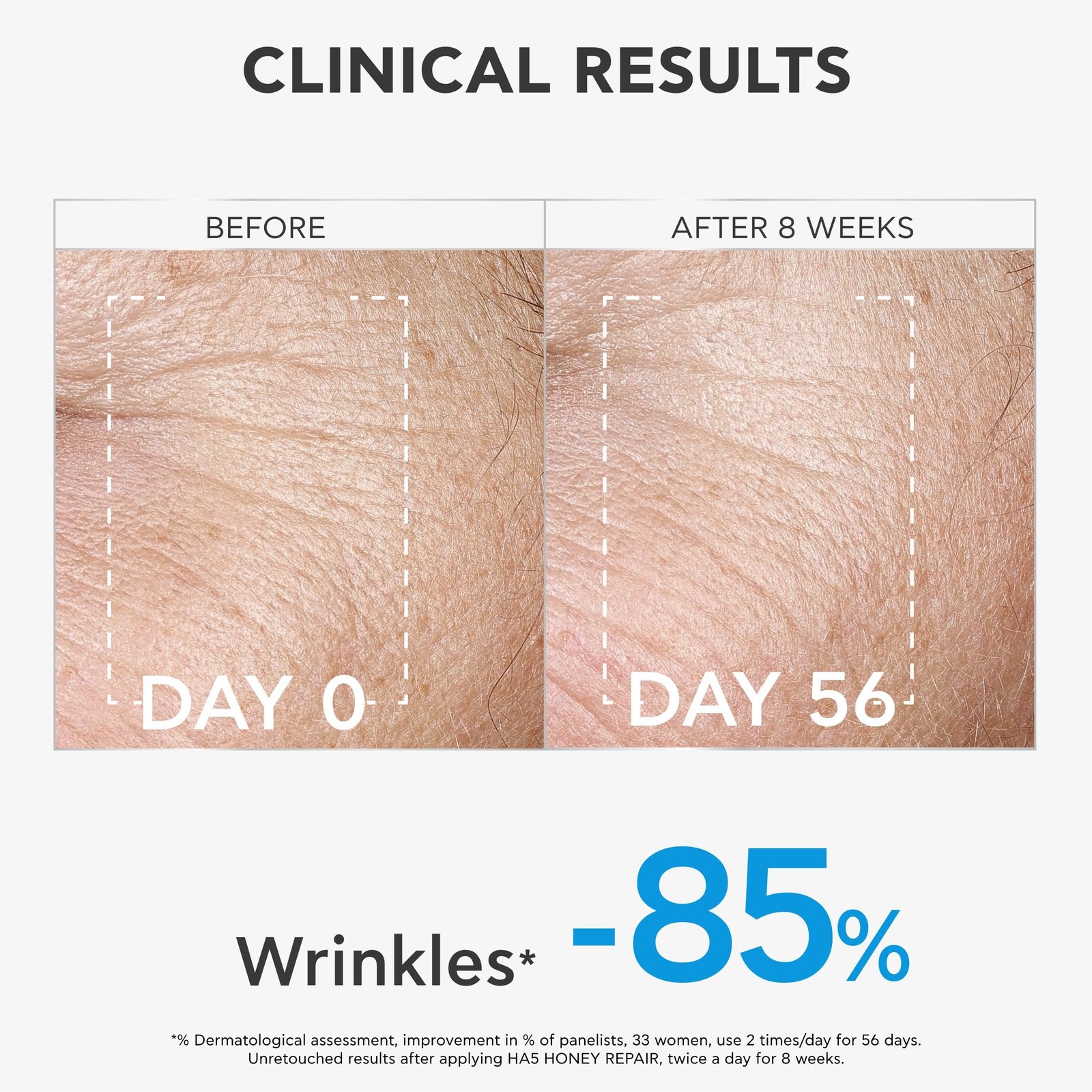 Apivita HA5 Honey Repair Serum 30ml