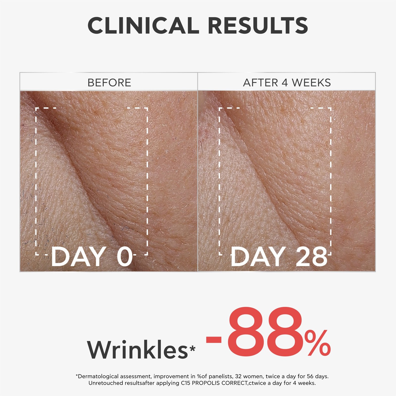 APIVITA C15 Propolis Correct Serum 30ml