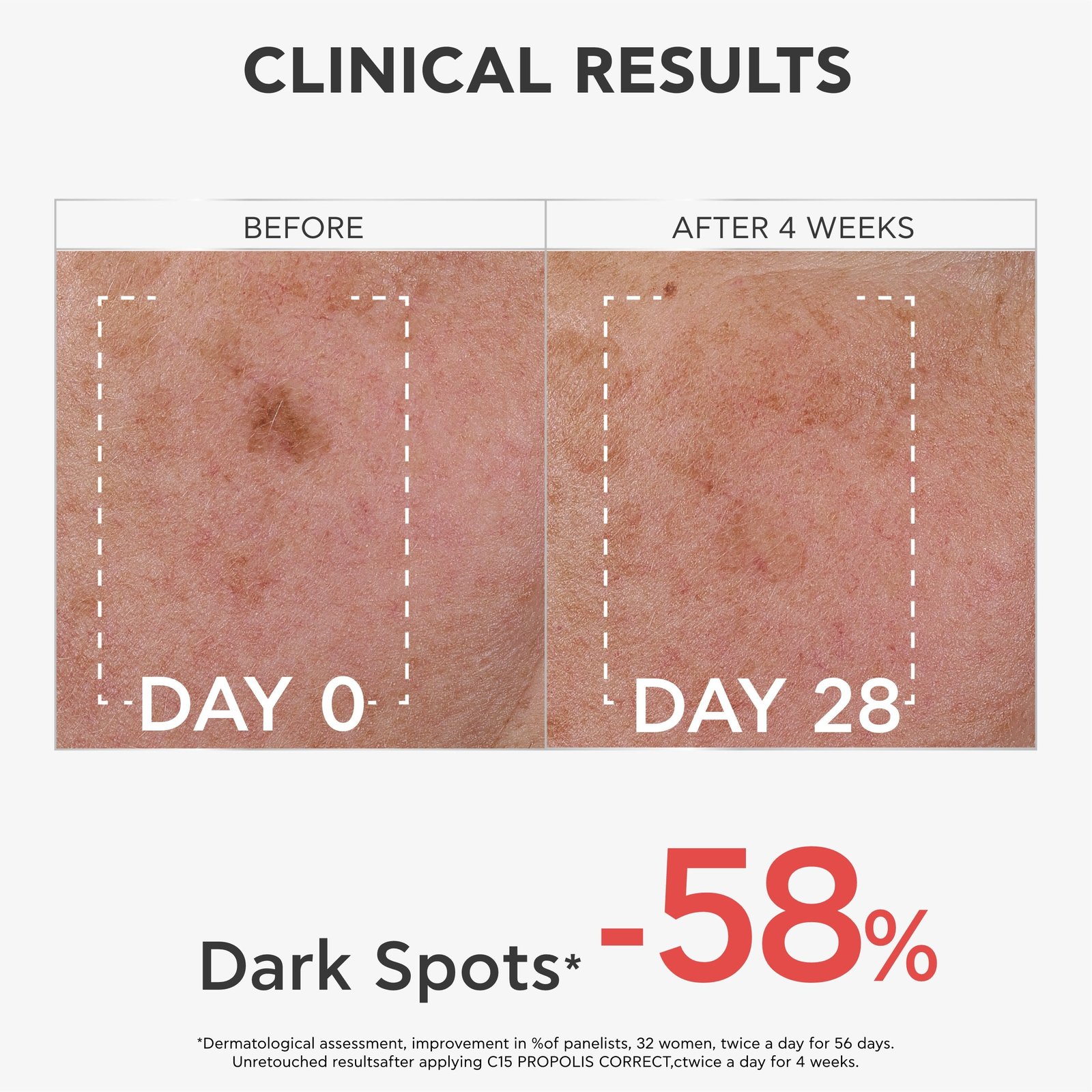 APIVITA C15 Propolis Correct Serum 30ml