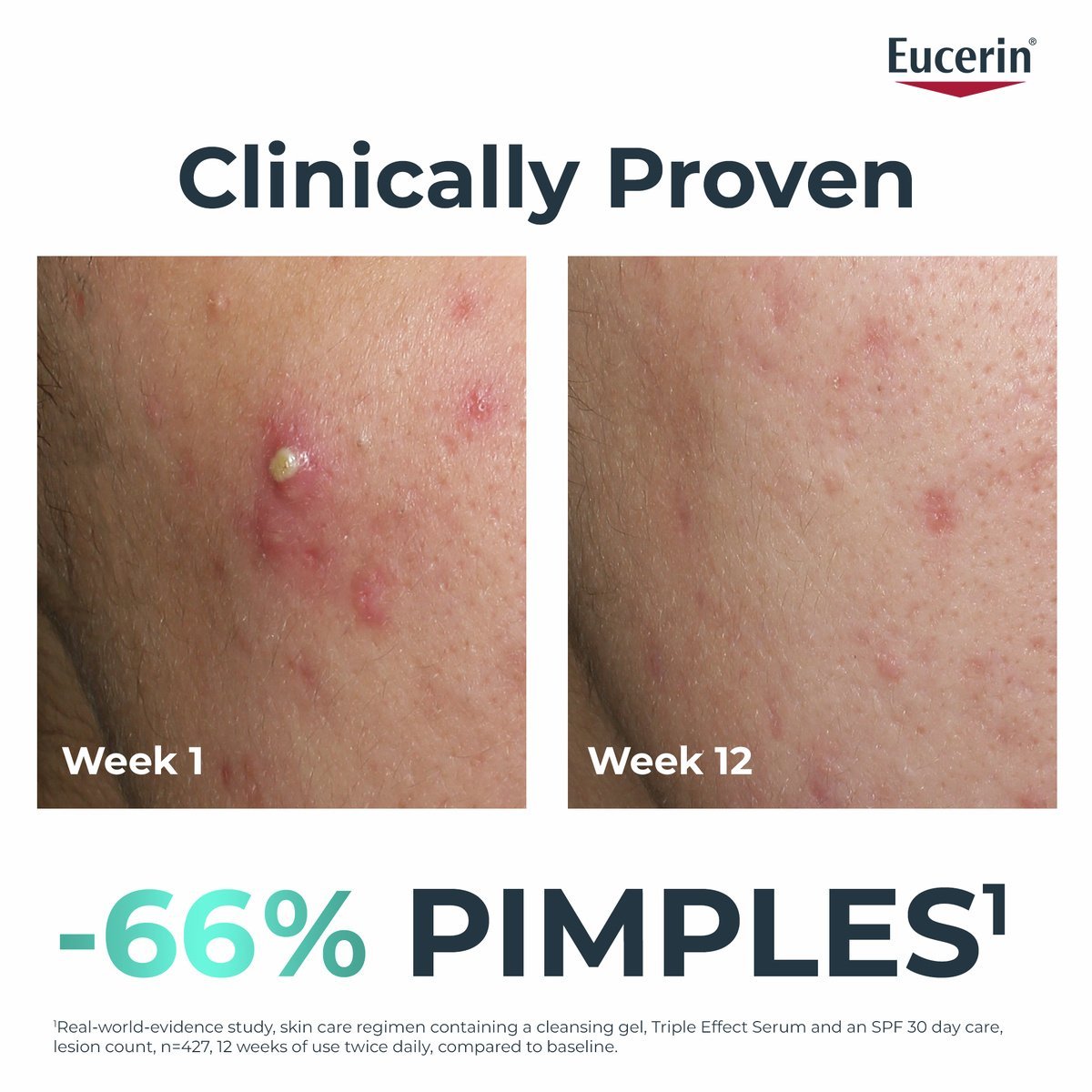 Eucerin DERMOPURE Oil Control Triple Effect Serum 40ml