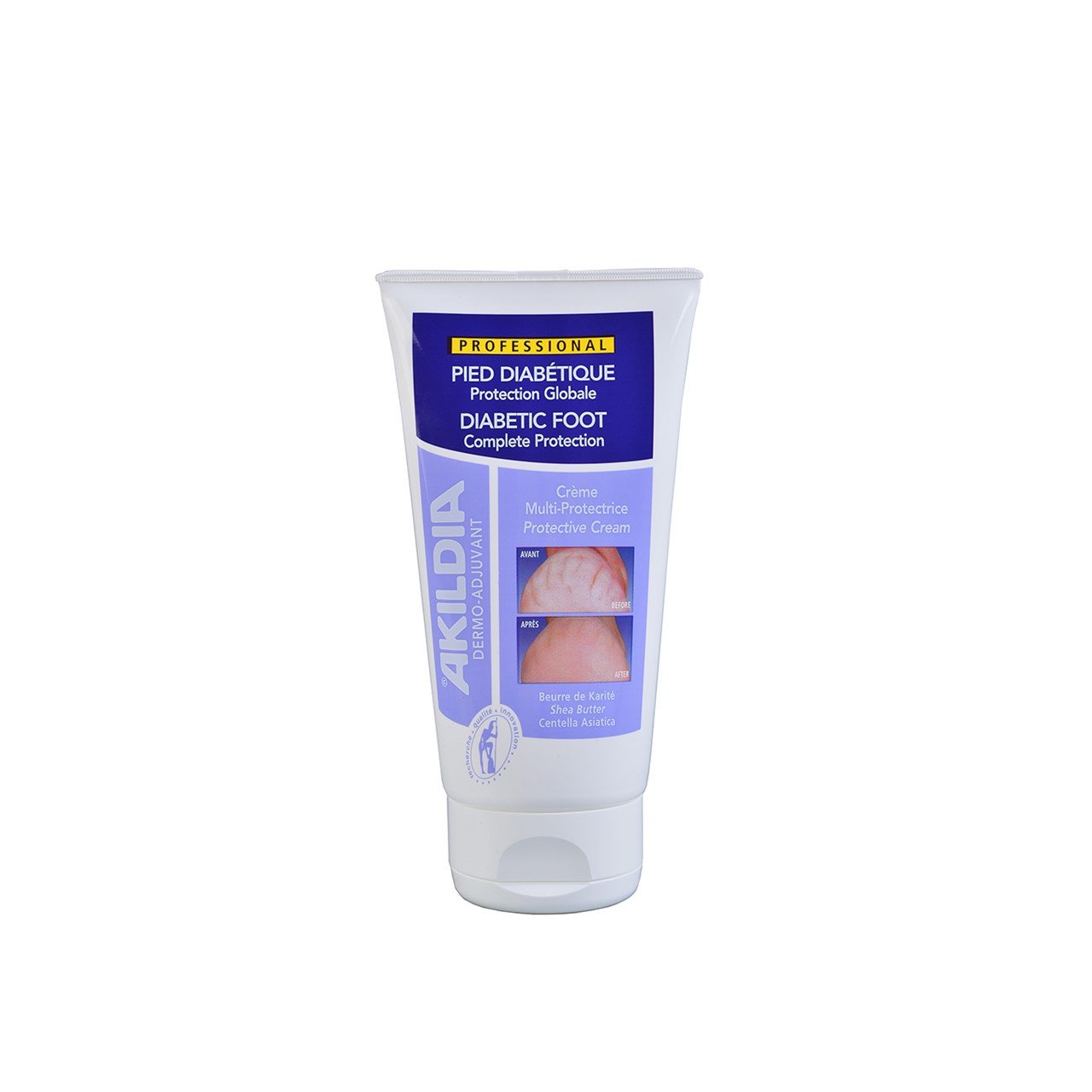 Akildia Diabetic Foot Protective Cream 150ml (5.07fl oz)