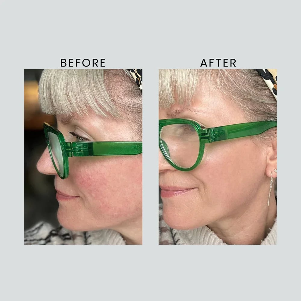 Altruist Anti-Redness & Pigmentation Light Tinted Facial Moisturizer SPF50 30ml