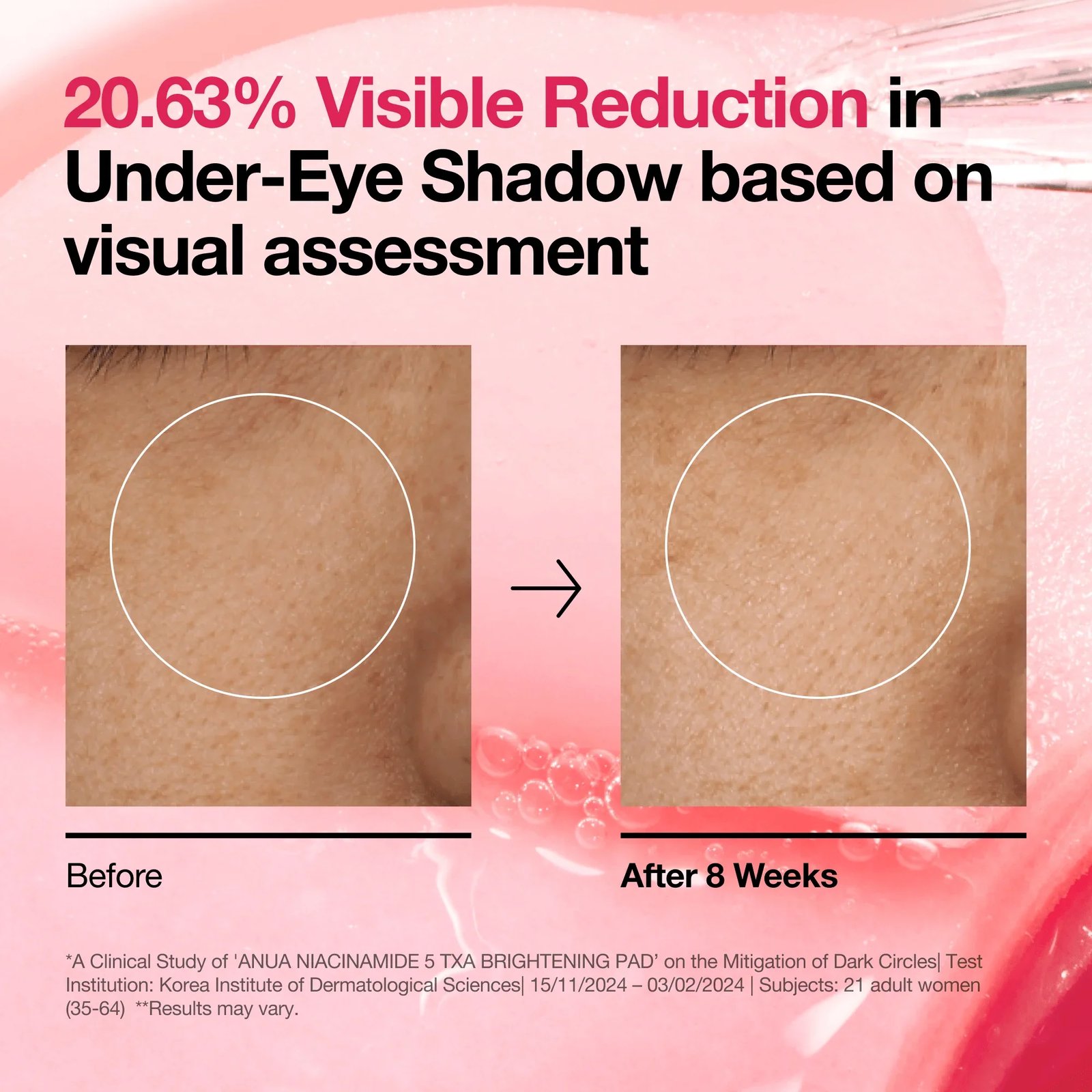 Anua Niacinamide 5 TXA Brightening Pad x60