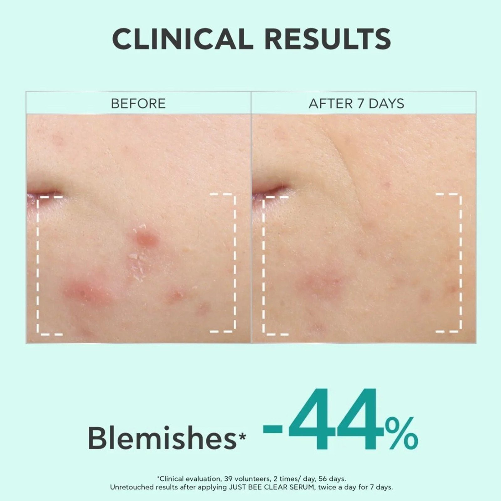 APIVITA Just Bee Clear Refining Serum 30ml