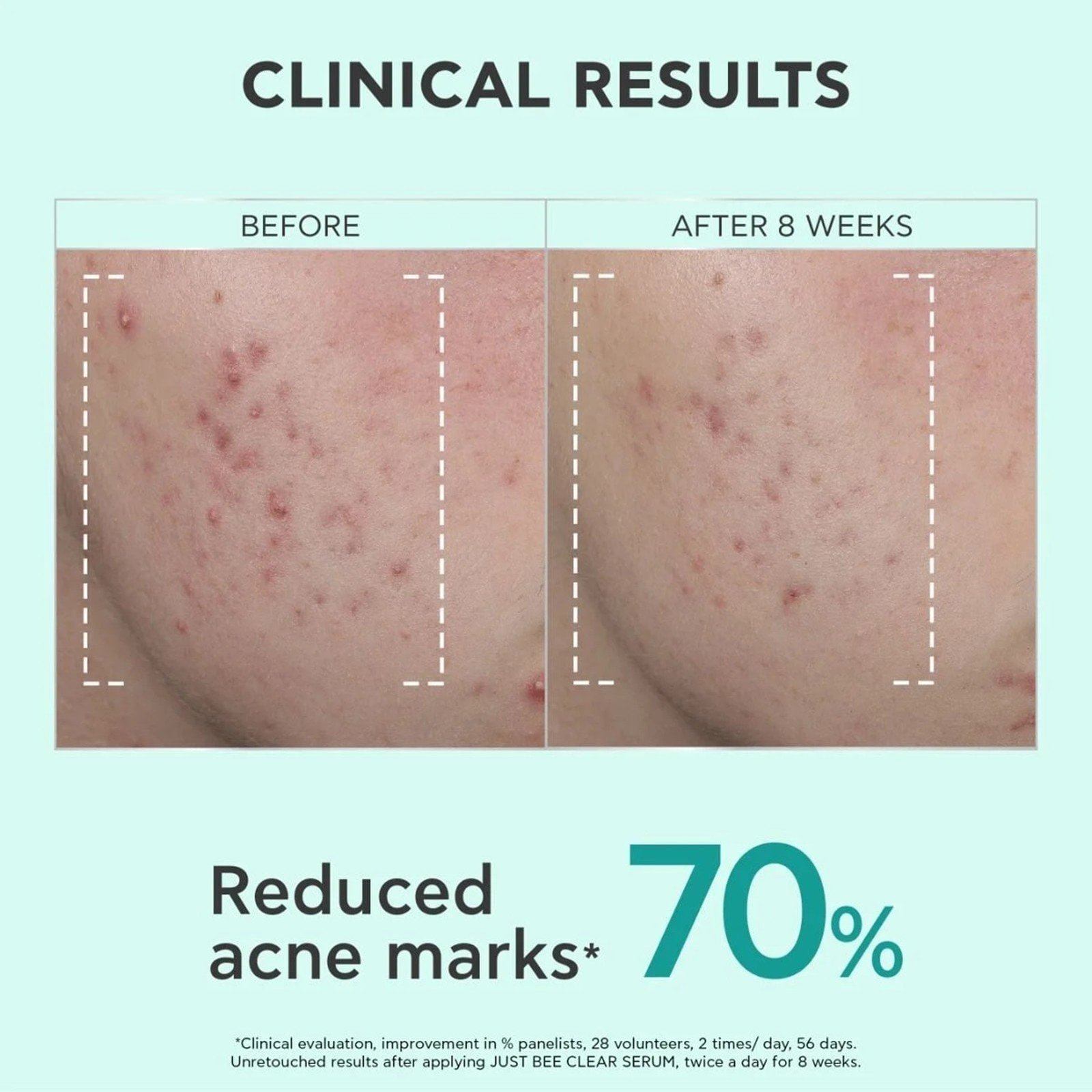 APIVITA Just Bee Clear Refining Serum 30ml