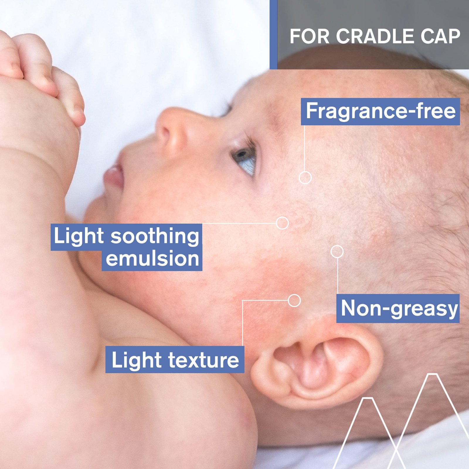 Uriage Baby 1st Cradle Cap Care Cream 40ml