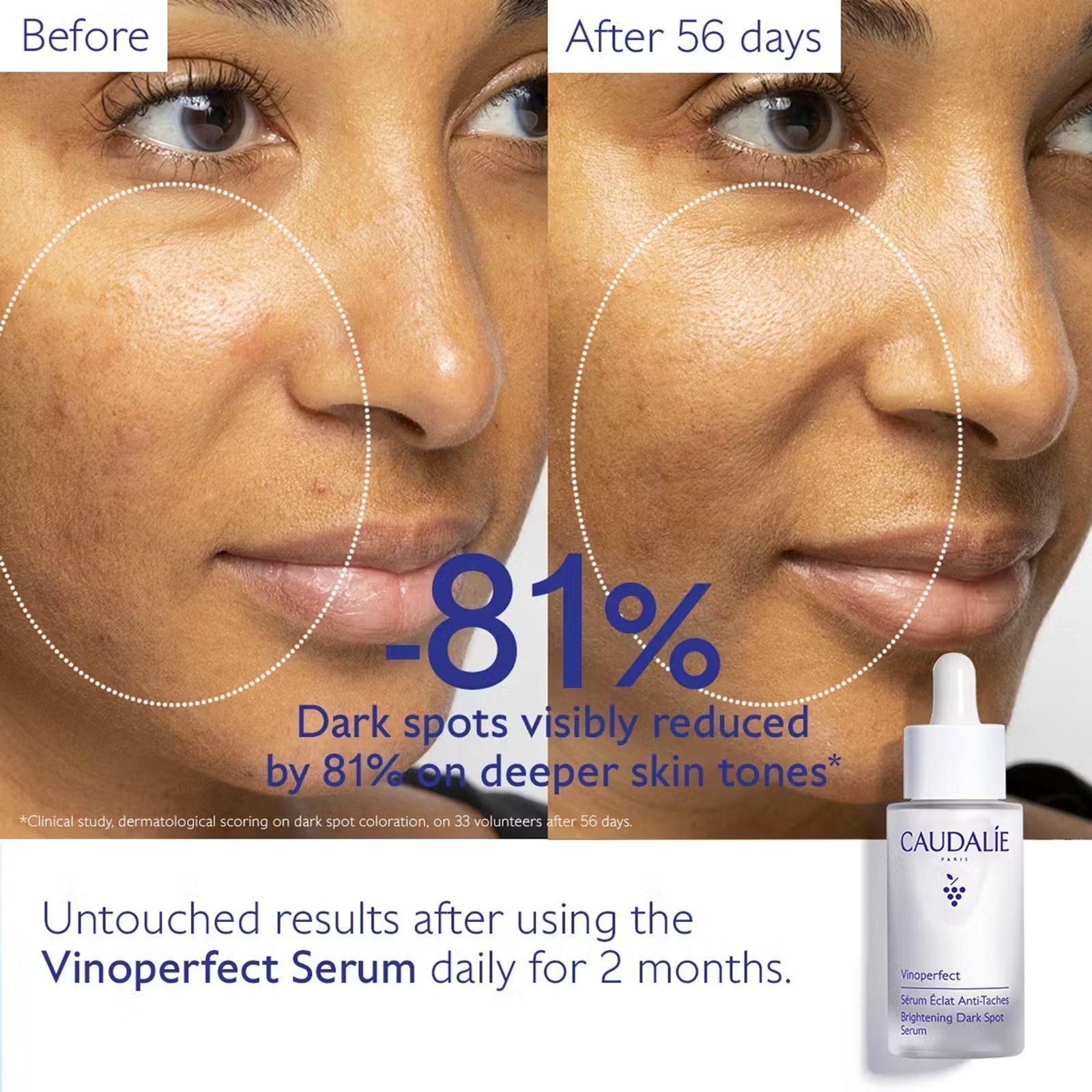 Caudalie Vinoperfect Brightening Dark Spot Serum 30ml