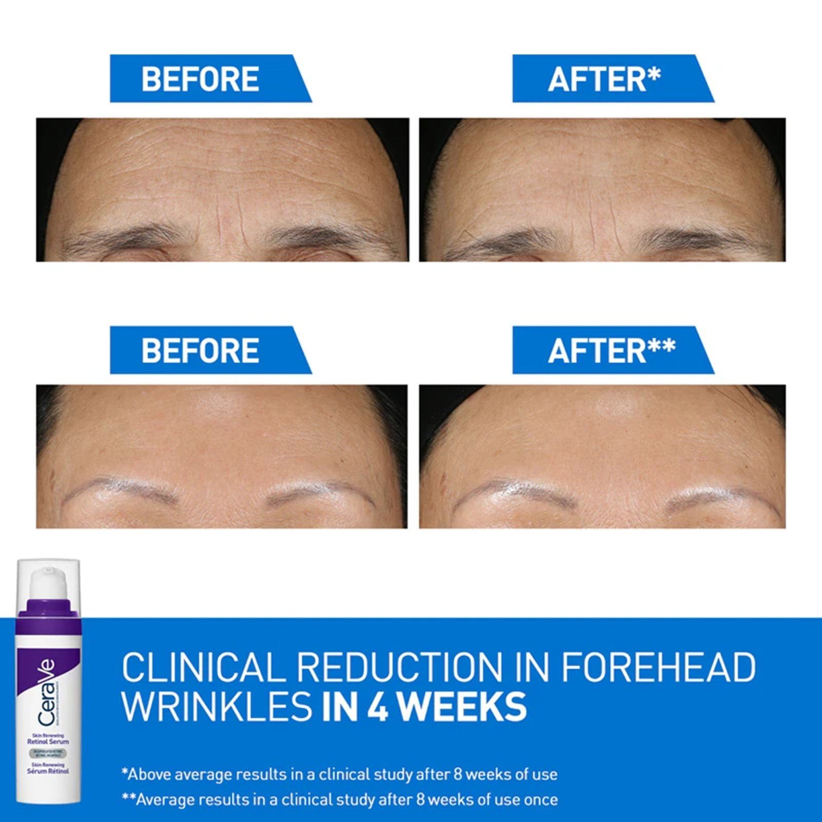 CeraVe Skin Renewing Retinol Serum 30ml