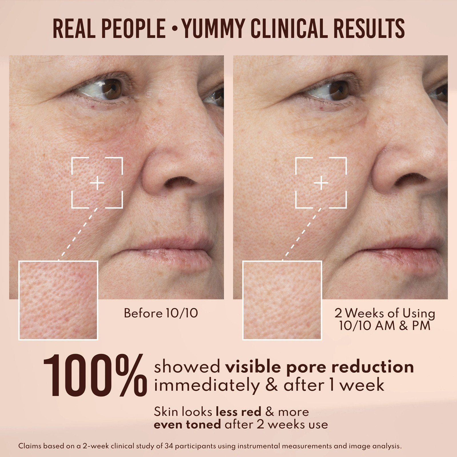 Danessa Myricks Beauty Yummy Skin 10/10 Barrier Boost Hyaluronic Acid + Ectoin Plumping Serum 50ml