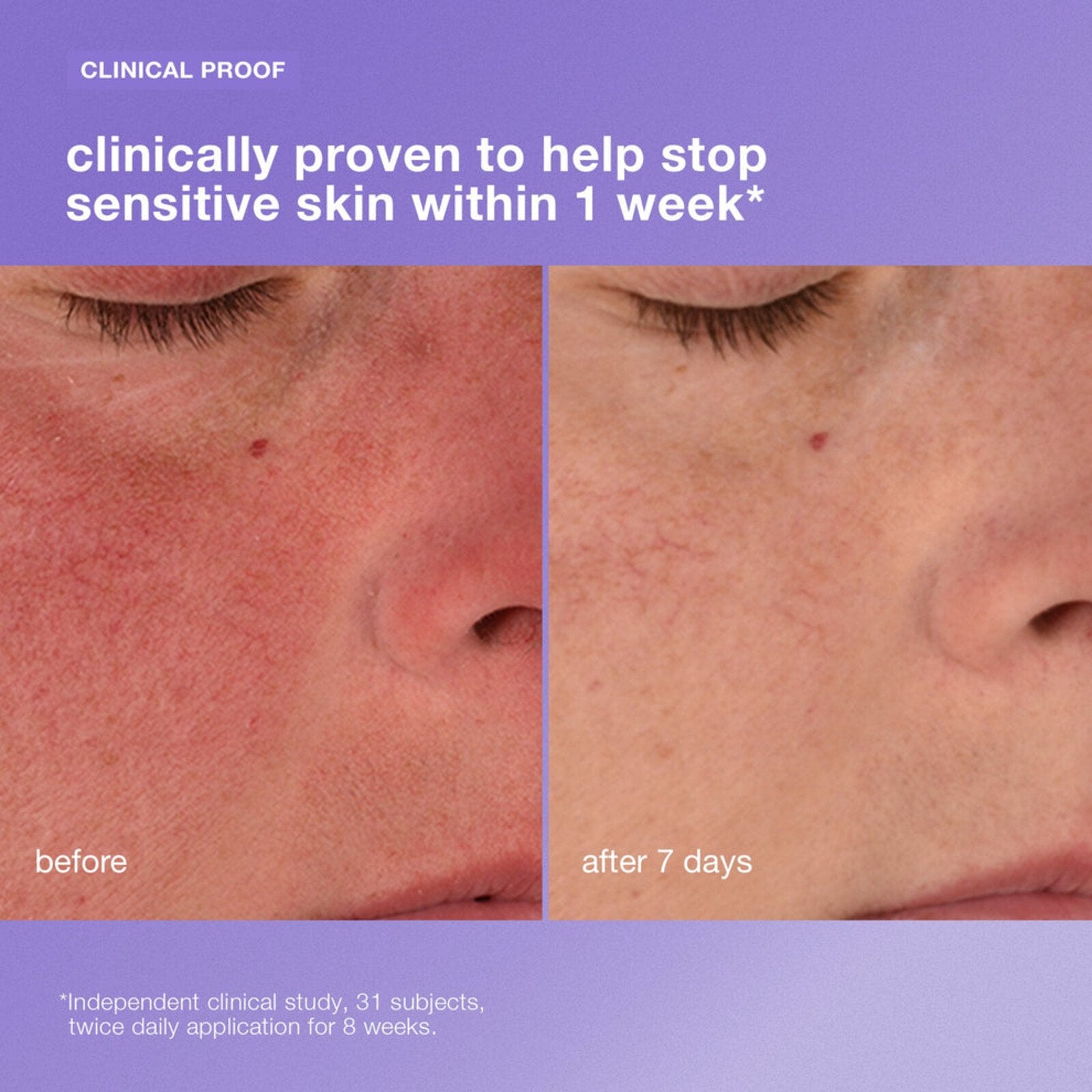 Dermalogica Stabilizing Repair Cream 50ml (1.7floz)