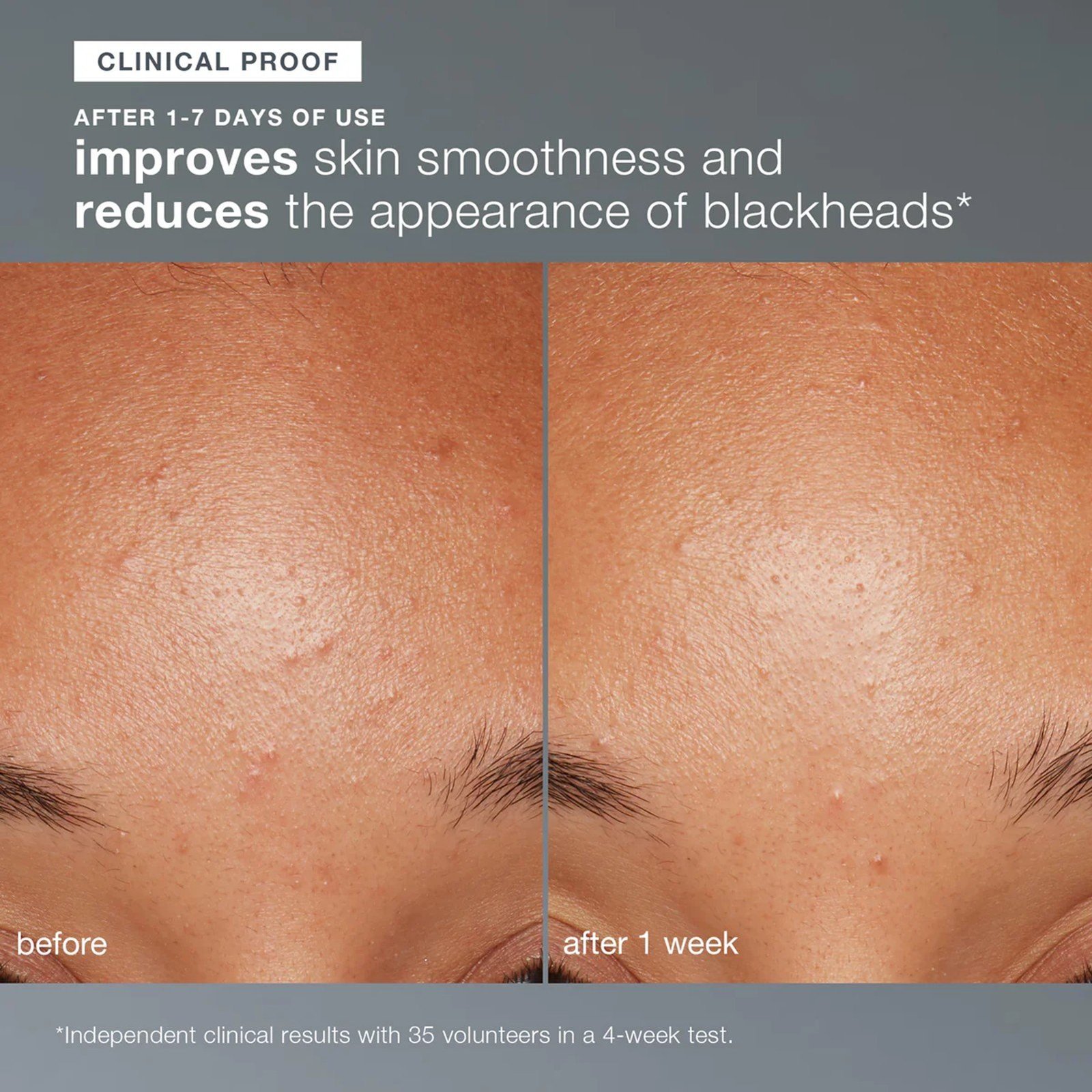 Dermologica Daily Microfoliant Exfoliator 40g (1.4oz)