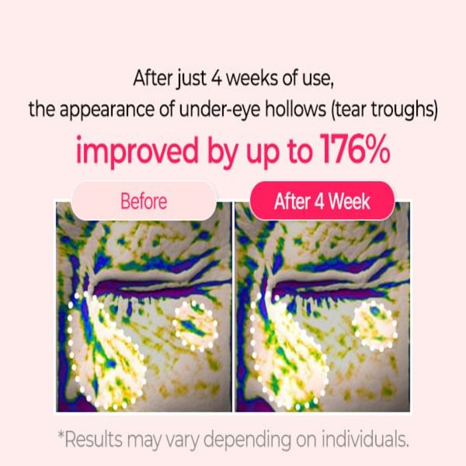 Dr.Melaxin Calcium Cemenrete Cyano Pink Spicule Cream 50g