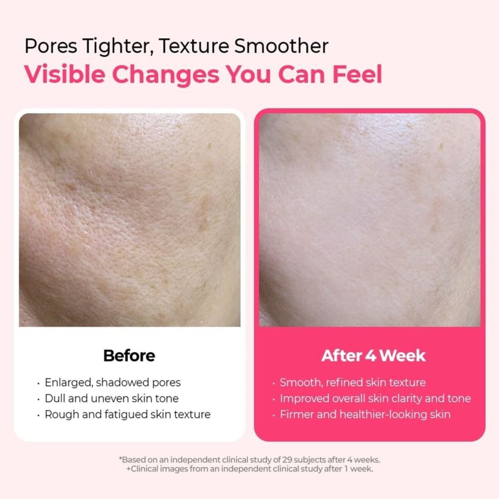 Dr.Melaxin Calcium Cemenrete Cyano Pink Spicule Serum 30ml (1.01floz)