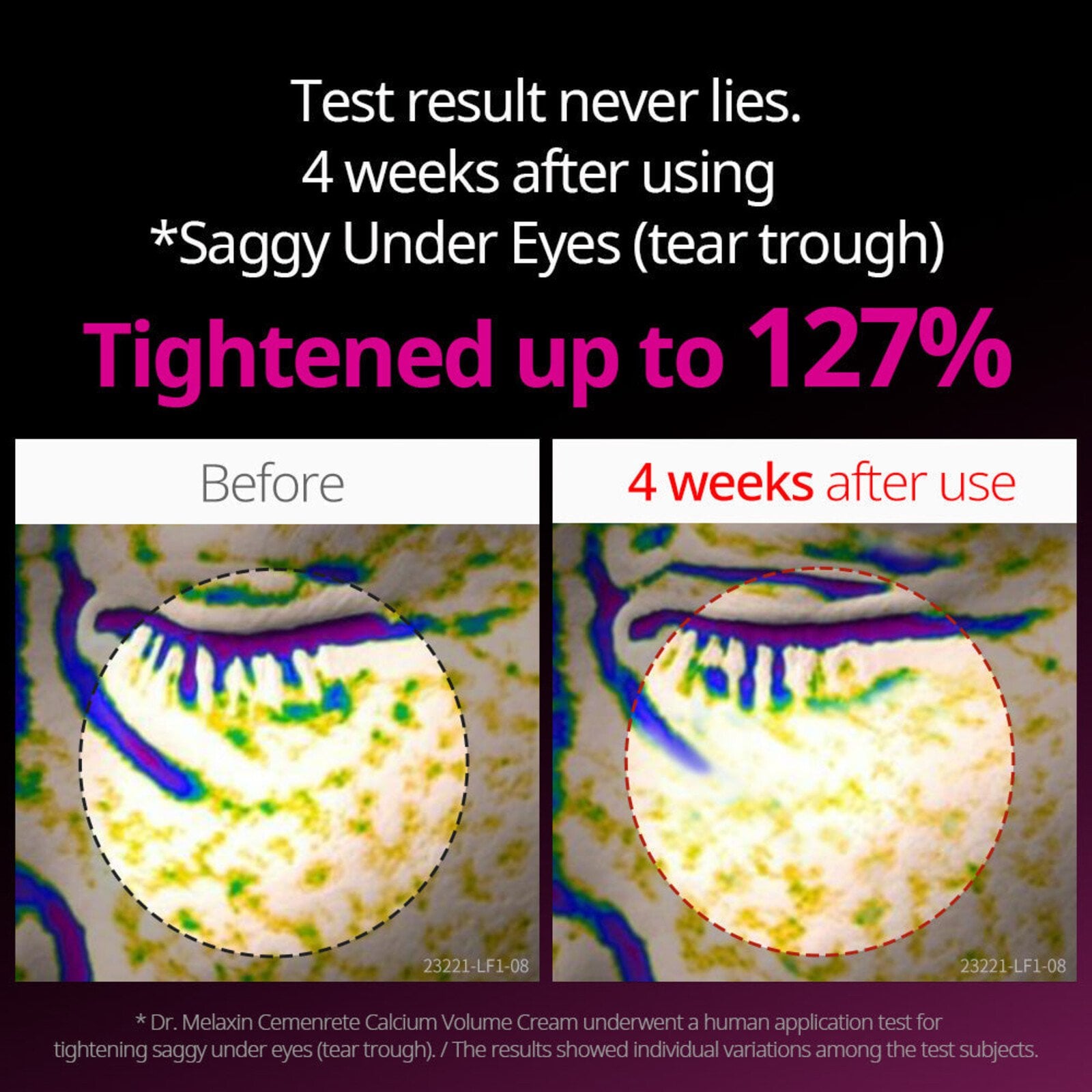 Dr.Melaxin Cemenrete Calcium Intense Ampoule Plus 30ml