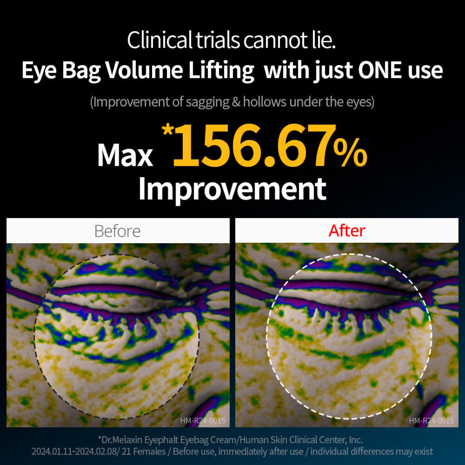 Dr.Melaxin Eyephalt Eyebag Cream 10g