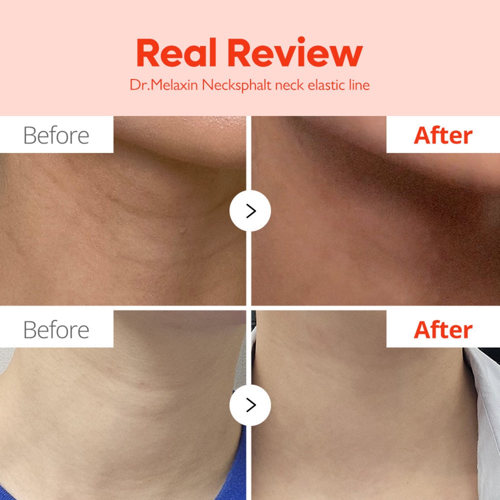 Dr.Melaxin Necksphalt ECM Ceramide Neck Serum 1.5ml x10