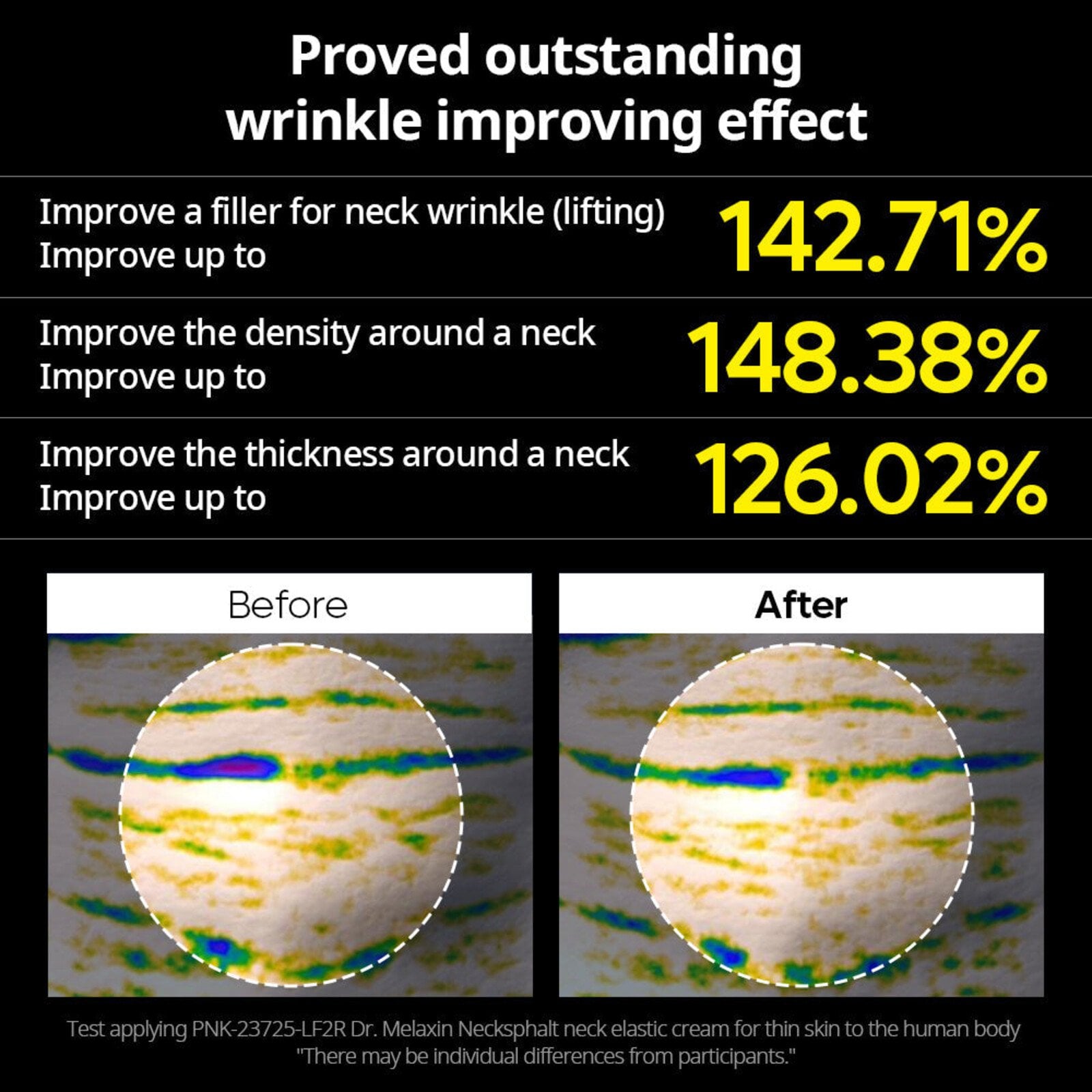 Dr.Melaxin Necksphalt ECM Neck Barrier Cream 50ml (1.69floz)