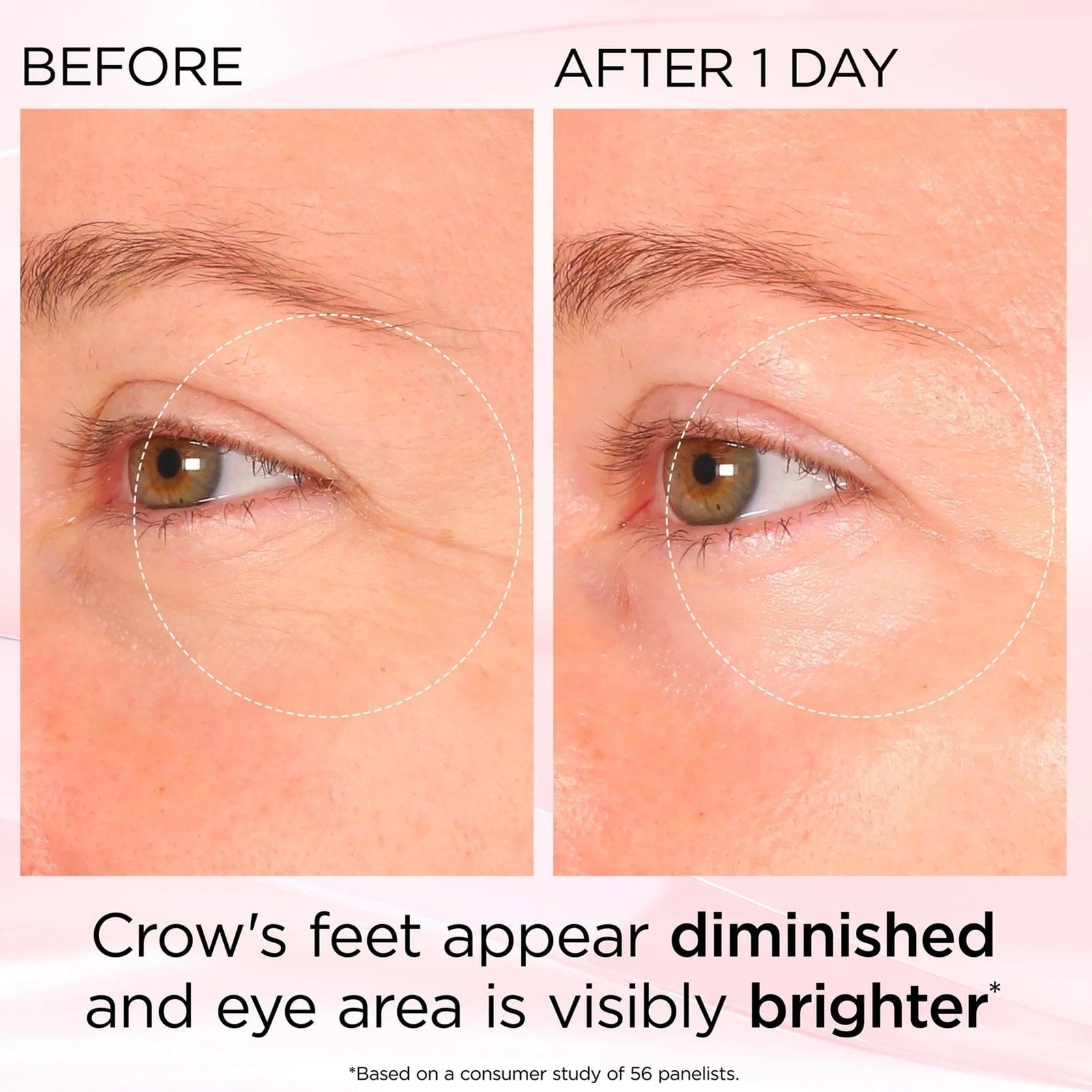 Elizabeth Arden Retinol + HPR Ceramide Rapid Skin Renewing Eye Cream 15ml (0.5floz)