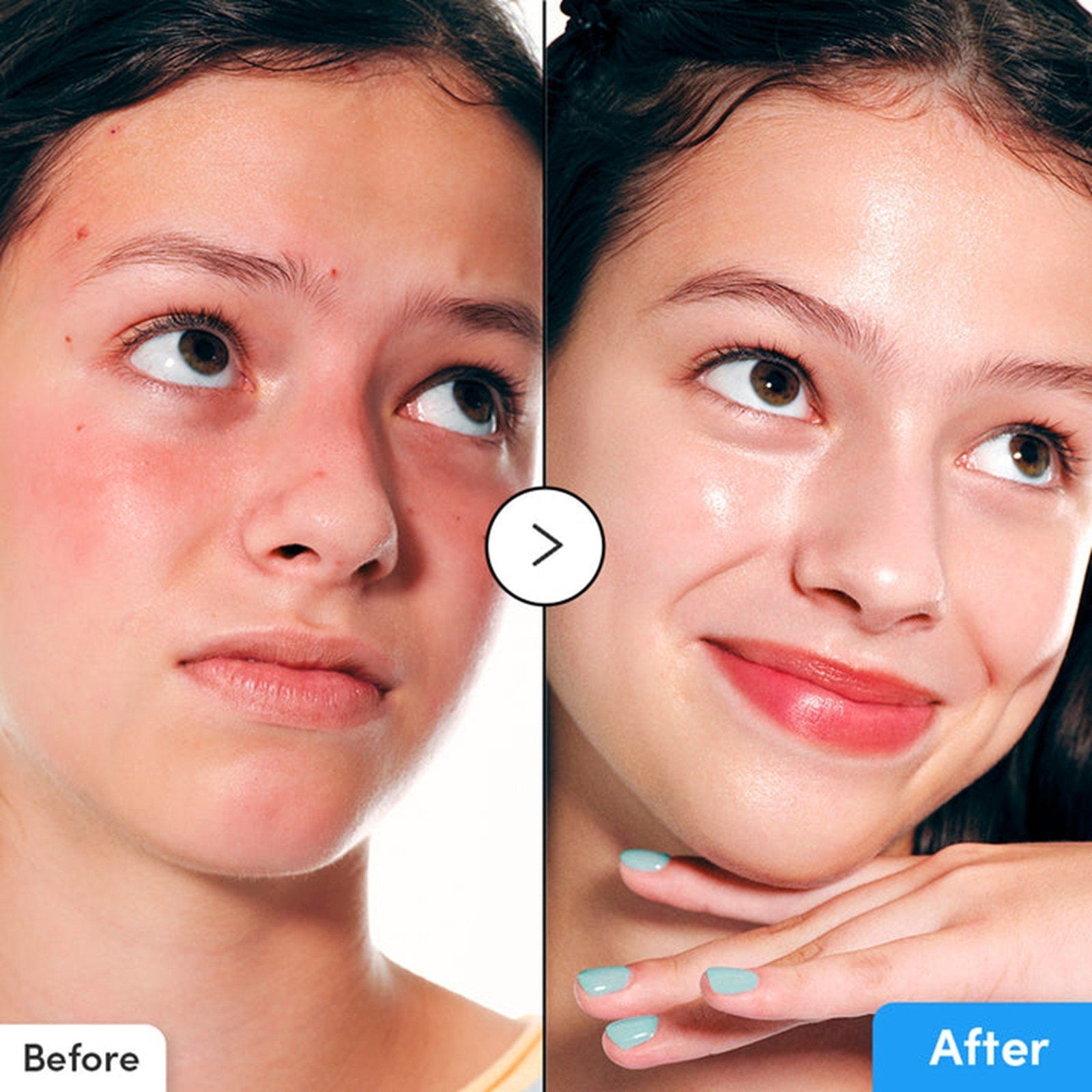 Eqqualberry Blue Blow Hyaluron Flooding Serum 30ml