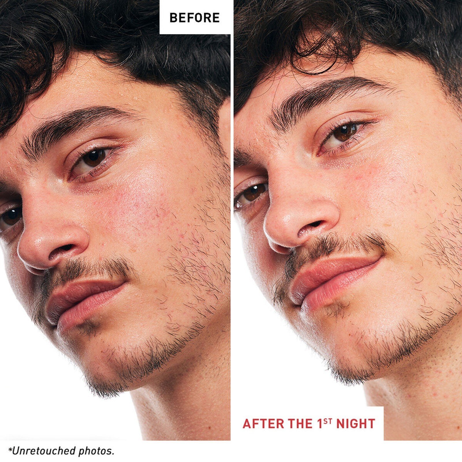 Erborian Skin Therapy Multi-Perfecting Night Oil 30ml