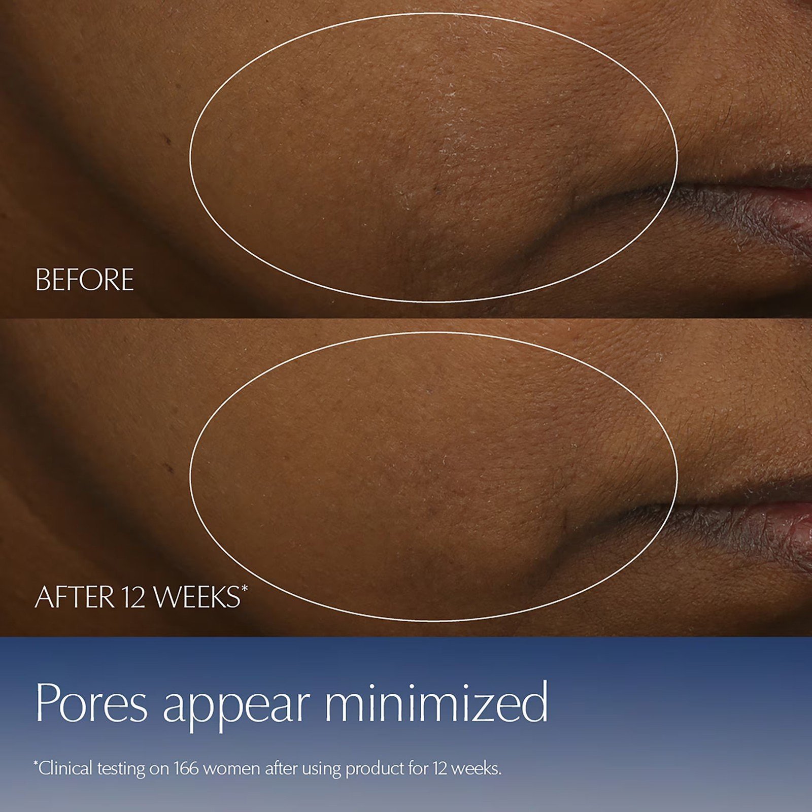 Estée Lauder Advanced Night Repair Synchronized Multi-Recovery Complex Serum 50ml