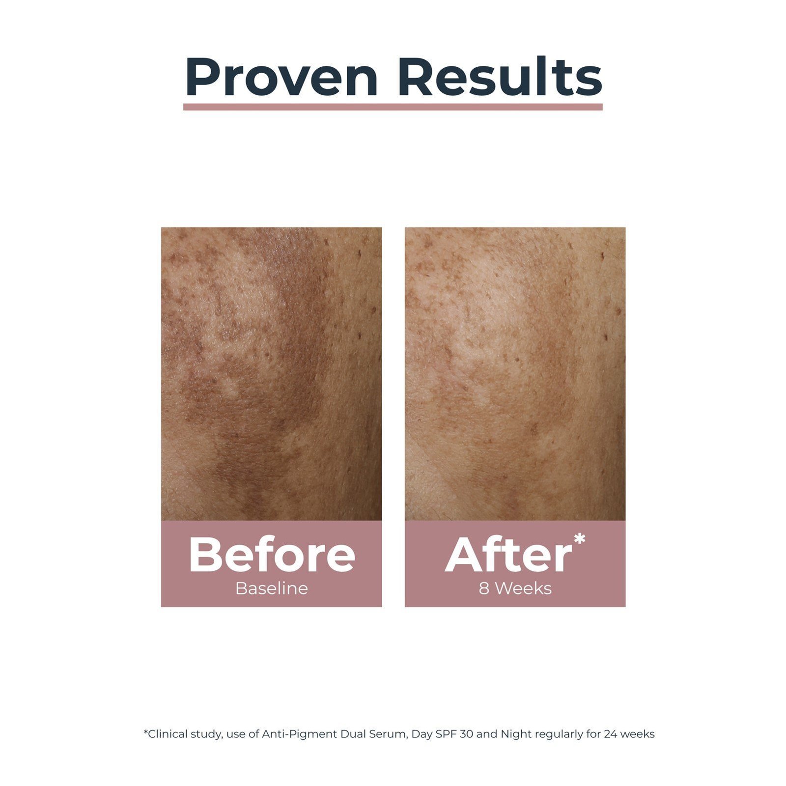 Eucerin Anti-Pigment Dual Serum 30ml