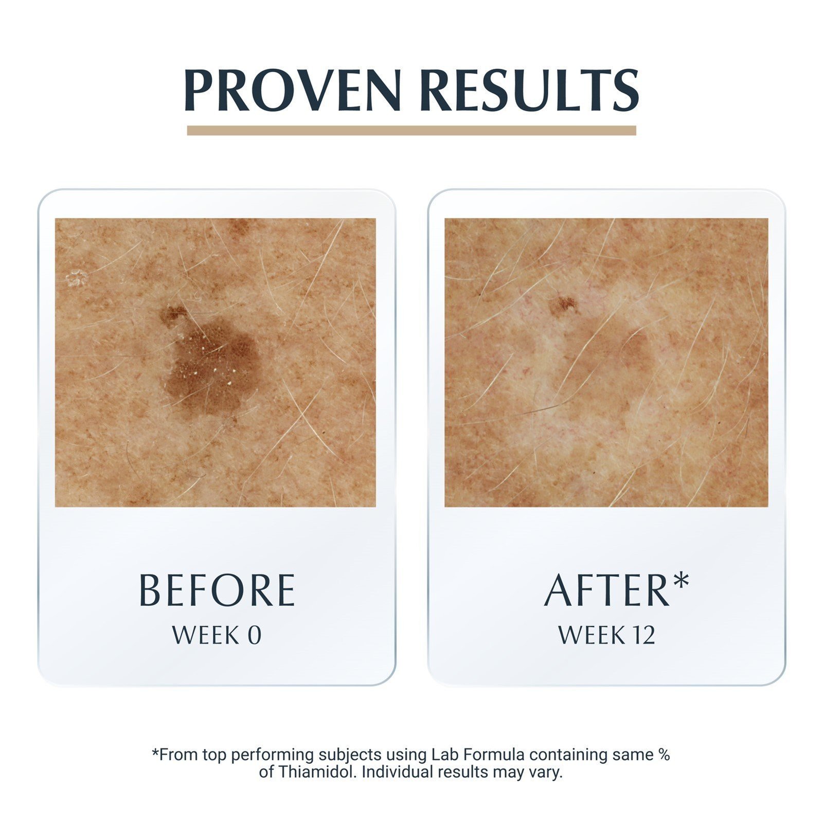 Eucerin Hyaluron-Filler + Elasticity 3D Serum 30ml