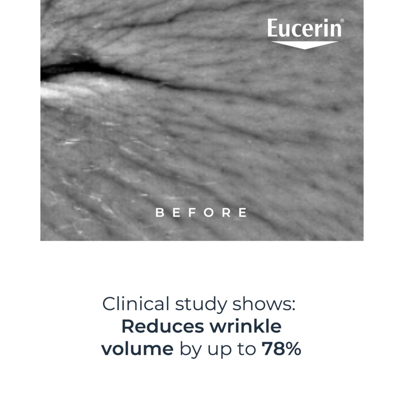 Eucerin Hyaluron-Filler Epigenetic Serum Anti-Age 30ml
