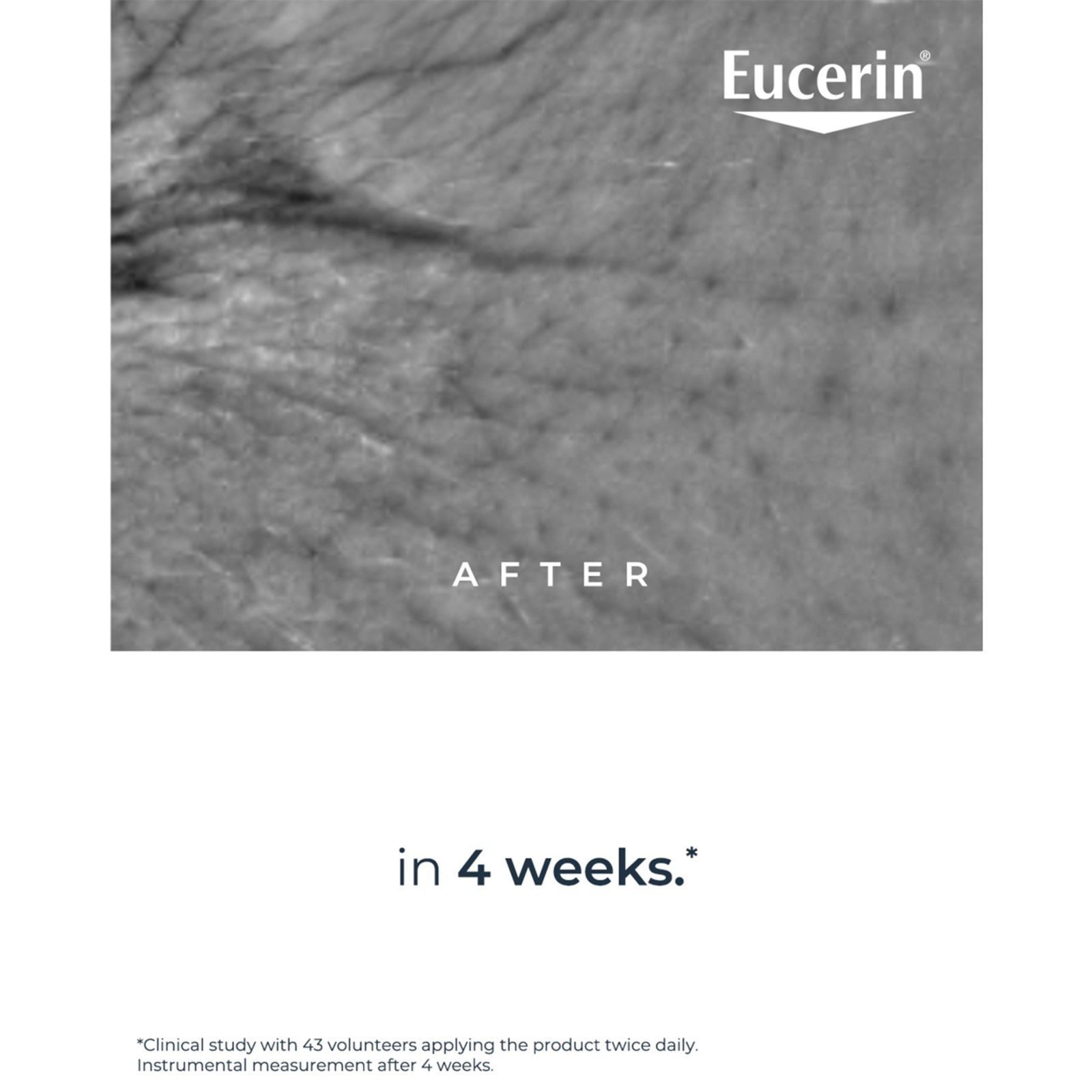 Eucerin Hyaluron-Filler Epigenetic Serum Anti-Age 30ml